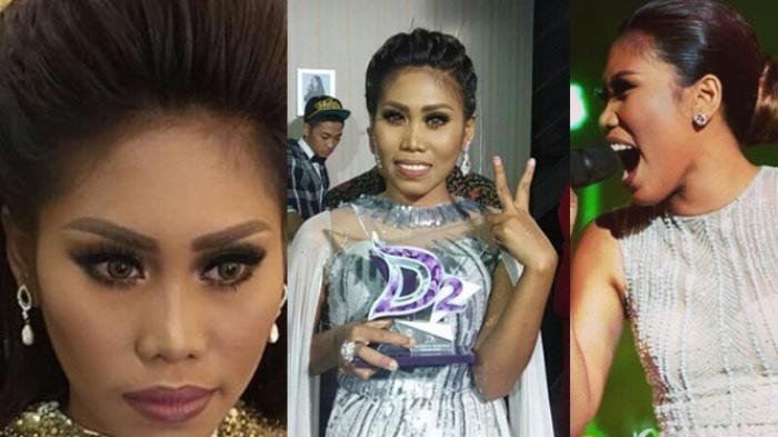 Dinyinyiri Wajahnya Kurang Menarik, Perubahan Hidung Evi Masamba Diungkap Artis Ini