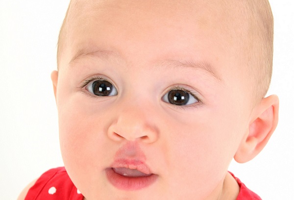 Waspadai Tanda Lahir Pada Bayi Jika Memiliki Ciri Seperti Ini