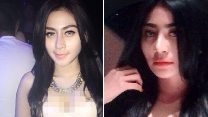 Fakta-fakta Si Cantik yang Menabrak Driver Ojek Online Hingga Kondisinya Mengerikan
