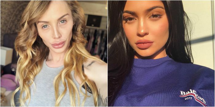 transgender-ini-melakukan-operasi-plastik-agar-mirip-kylie-jenner_20180405_143249.jpg
