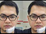Dagu-Tommy-Kurniawan-Harus-Terima-14-Jahitan-Terungkap-Penyebabnya.jpg