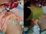 Kondisi Terkini Balita di Bengkulu yang Keluarkan Cacing dari Hidung dan Mulut