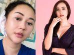 artis-aura-kasih-jalani-operasi-karena-gendang-telinga-bocor.jpg