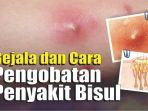 gejala-dan-cara-pengobatan-penyakit-bisul.jpg