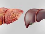 ilustrasi-organ-hati_20161102_110025.jpg