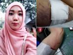 lepas-kb-implan_20180504_095633.jpg