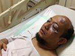 novel-baswedan_20170411_080156.jpg