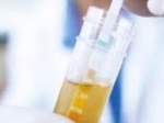 tes-urine.jpg