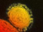 virus-mers_20150613_082701.jpg