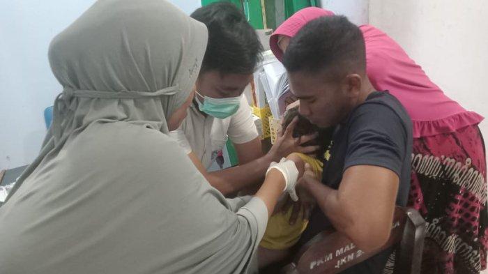 WASPADA 31 Warga Madapangga Bima Digigit Anjing Rabies