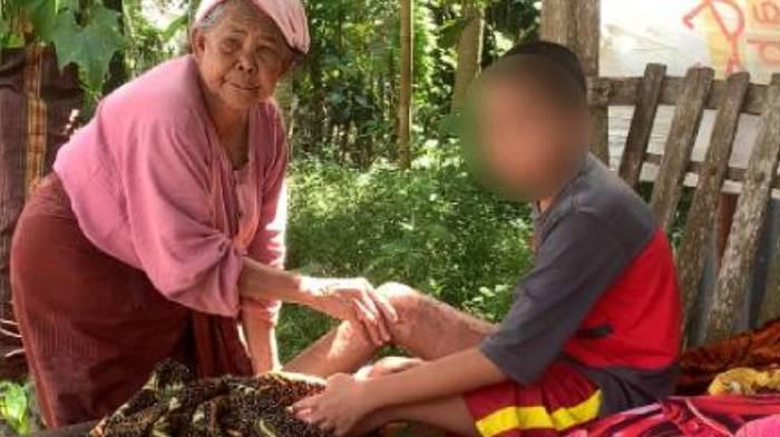PENYELIDIKAN KASUS - SAH (13), salah satu korban yang selamat kasus pembakaran santri dirawat pihak keluarga di rumahnya.