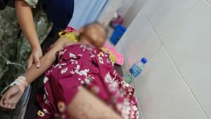 SERANGAN-ANJING-DI-TERARA.jpg