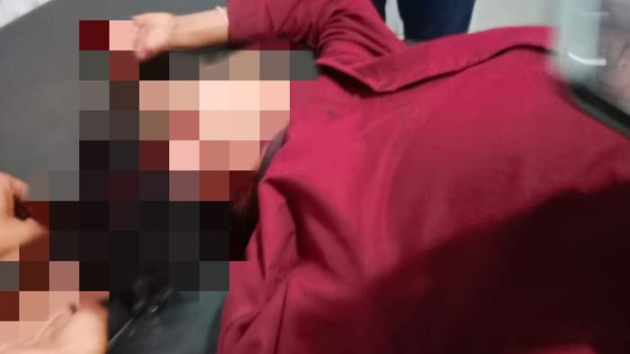 Remaja di Dompu Dianiaya Pencuri saat Membantu Mengejar Maling