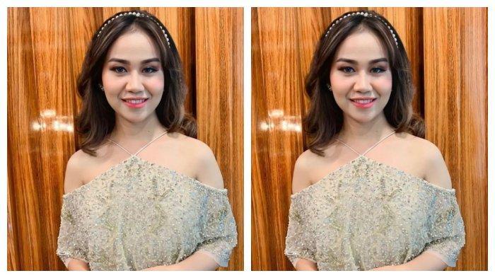Mayang Adik Vanessa Angel Lakukan Operasi Hidung, Ini Alasannya