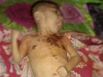 m-fajar-aminullah-disabilitas-bima.jpg