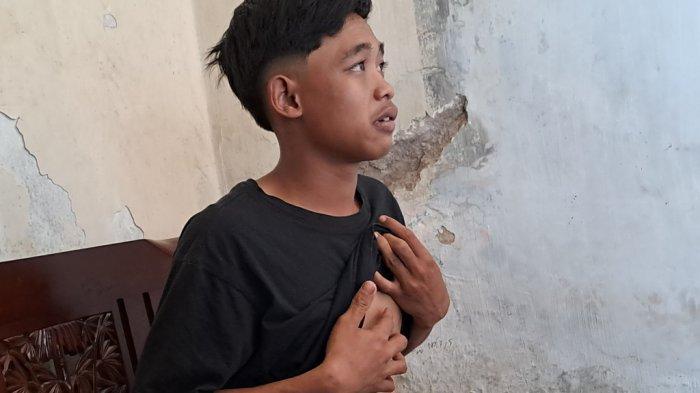 Derita Korban Selamat Tragedi Kanjuruhan, Kini Susah Cari Kerja: 3 Kali Melamar Tak Pernah Diterima