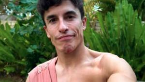 Marc-Marquez-mengalami-patah-tulang-setelah-kecelakaan-di-MotoGP-Indonesia-2025.jpg