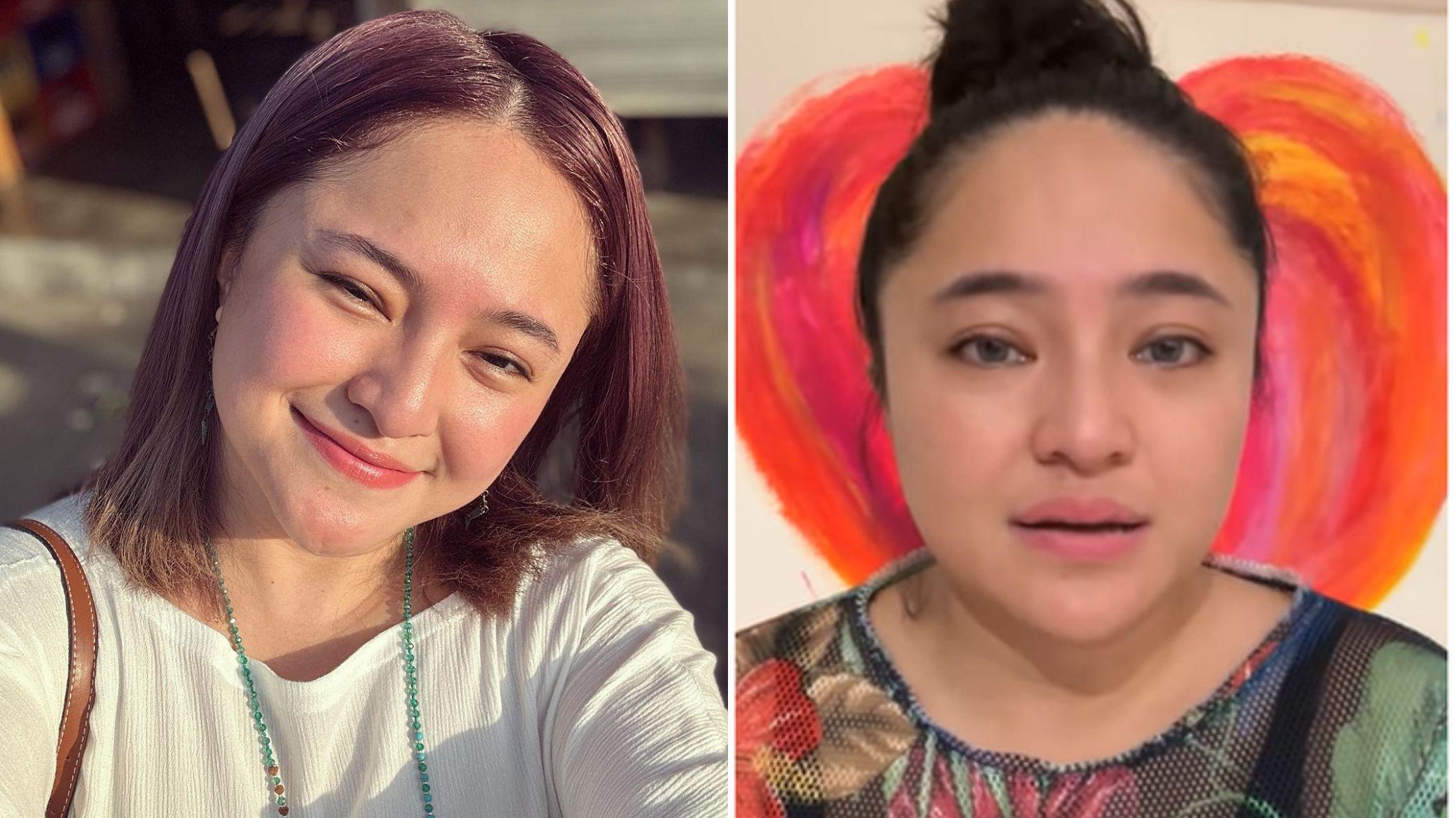 Marshanda Blak-blakan Punya Banyak Utang, Imbas Idap Tumor 2 Kali, 'Gak Diterima Asuransi Kesehatan'
