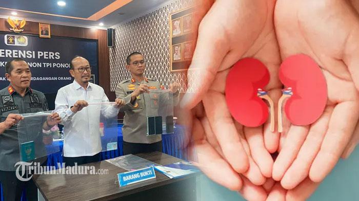 kasus-perdagangan-ginjal-internasional.jpg