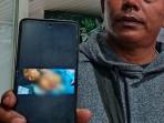 Korban-ST-37-korban-pembacokan-saat-menjalani-perawatan-medis-di-RSUD-Soewandhie.jpg