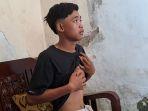 Korban-selamat-Tragedi-Kanjuruhan-Nur-Saguanto-menunjukkan-luka-di-dada.jpg