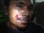 PENUSUKAN-DI-SPBU-Tampang-pelaku-penusukan-SU-diamankan-di-Mapolres.jpg