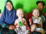 anak-kembar-albino-di-wonogiri-nadya-nur-azzahra-dan-nadira-nur-ainiyah-bersama-kedua-orangtuanya.jpg