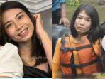 kisah-wanita-gagal-botox-sampai-tak-bisa-tertawa-4-bulan.jpg