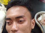 warga-sumenep-dapat-penganiayaan.jpg