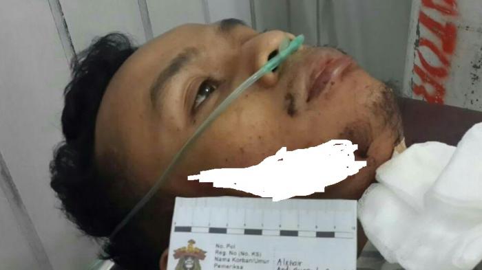 Perampok Beraksi di Mannuruki, 1 Warga Terkena Parang