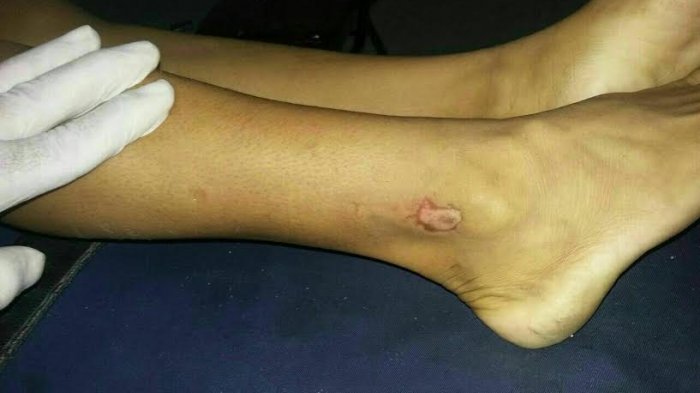 Gadis Parannassang Jeneponto Tewas Luka-luka Dekat Kandang Ayam, Perhiasan Emasnya Raib - ditemukan-tewas-40_20170504_112535.jpg