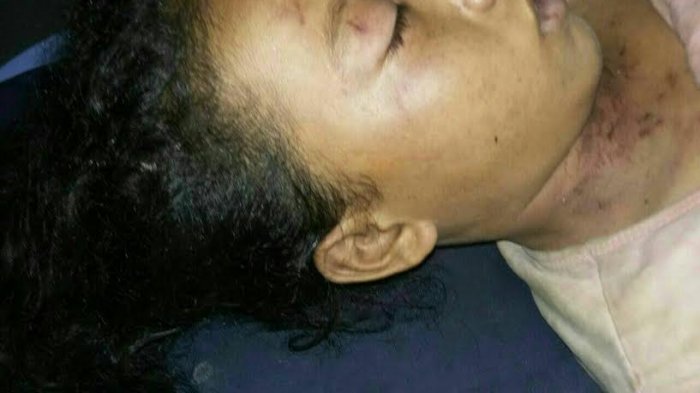 Gadis Parannassang Jeneponto Tewas Luka-luka Dekat Kandang Ayam, Perhiasan Emasnya Raib - ditemukan-tewas_20170504_112443.jpg