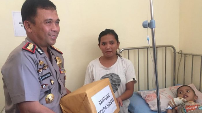Begini Kepedulian Wakapolda Sulbar Terhadap Bocah Gizi Buruk di RSUD Polman