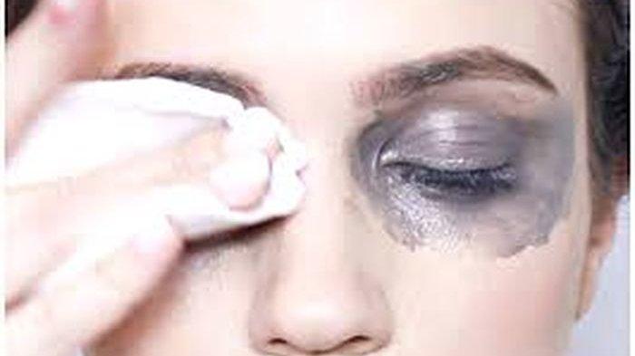 Cewek Ini Alami Hal Mengerikan Gegara Tak Hapus Make Up 2 Tahun, Menyesal Seumur Hidup