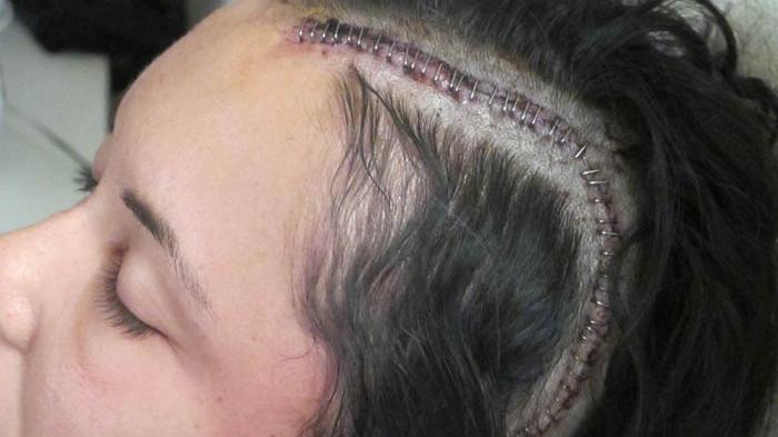 Lihat, Beginilah Bahaya Handphone 3G