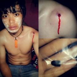 Satu Mahasiswa Tertembak pada Aksi Bentrok di Jl AP Pettarani