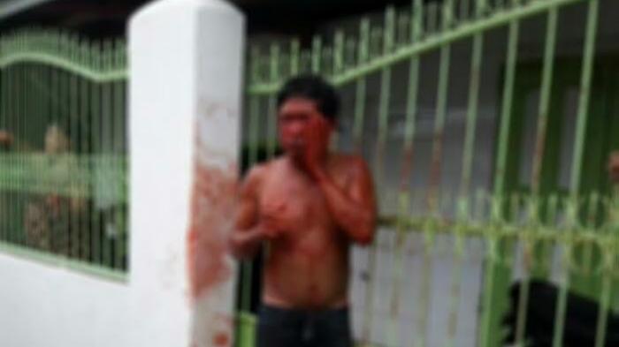 Ternyata Pria yang Diamuk Warga di Jl Manuruki Makassar Spesialis Pembobol Rumah, ini Identitasnya