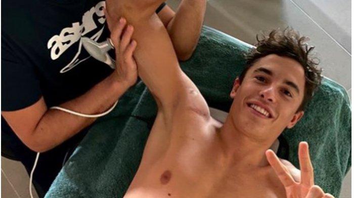 MotoGP 2020 - Marc Marquez Jalani Operasi Lagi