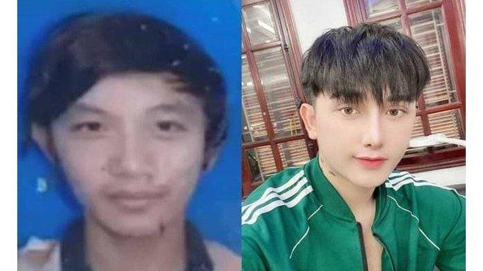 Bosan 9 Kali Melamar Kerjaan Ditolak, Pria Ini Kumpul Uang Lalu Operasi, Kini Kerjaan yang Datangi