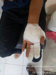 Percobaan Perkosaan Terjadi di Toraja, Modus Tawarkan Tumpangan
