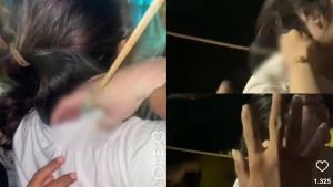 Kolase-tangkapan-layar-unggahan-akun-Instagram-kulitintamks-terkait-wanita-terkena.jpg