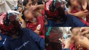 Screenshot-video-bocah-terkena-busur-di-lubang-hidungnya.jpg