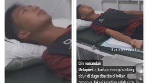 Viral-di-media-sosial-seorang-santri-diduga-sengaja-dibakar-temannya.jpg