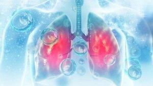 ilustrasi-Wabah-pneumonia-misterius-di-China-merebak.jpg