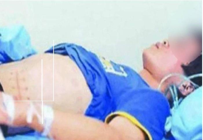 Ingat Remaja Jual Ginjal Demi Ponsel? 12 Tahun Berlalu Kondisinya Kini Pilu, Terpaksa Putus Sekolah