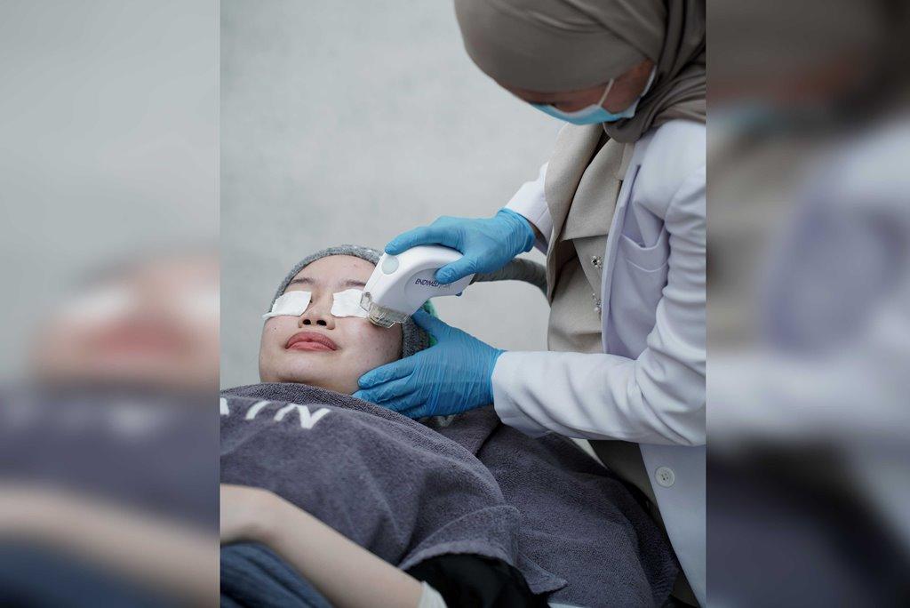 Anniversary Perdana, SKYN Clinic Makassar Beri Diskon Hingga 82 Persen