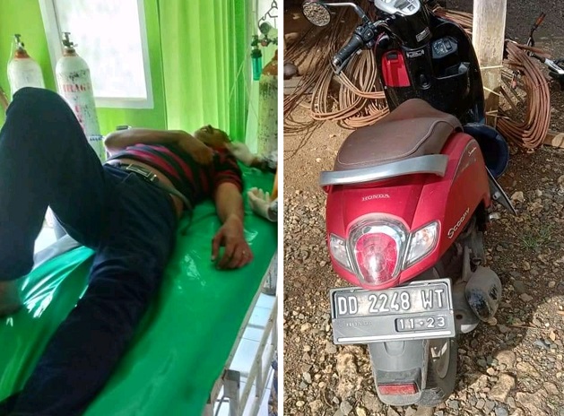 Injak Lubang, Warga Pangkep Alami Kecelakaan Tunggal di Desa Tungke Bone