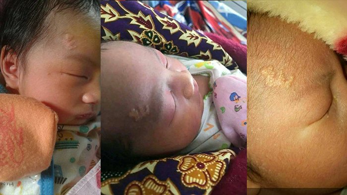 Baru Saja Lahir, Seorang Bayi Punya Lafaz 'Allah' di Dahinya dan Inilah Pekerjaan Orangtuanya