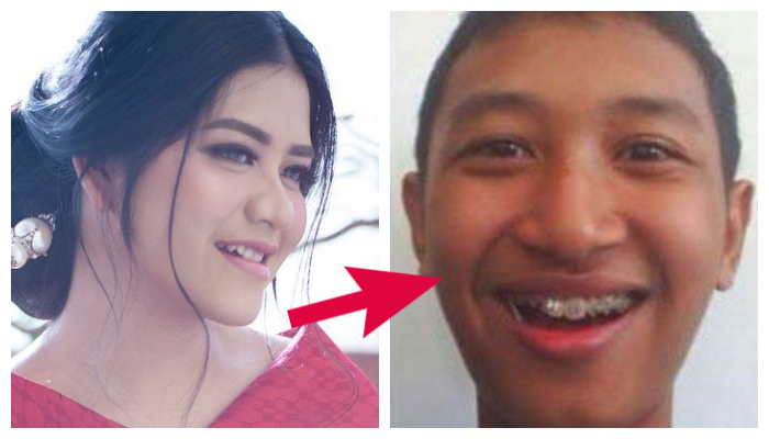 Ingat Haydar Pratama? Dulu Gagal Jadi Mantu Jokowi, Kehidupan Matan Pacar Kahiyang Ayu Kini Beda