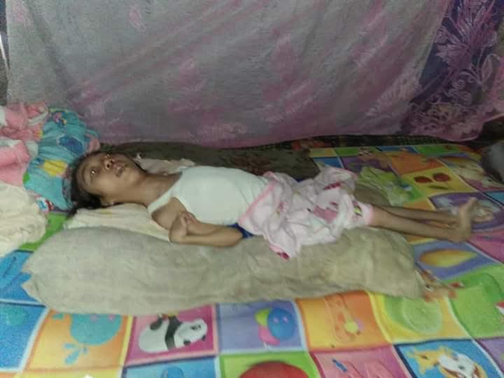 Sudah Puluhan Tahun Warga Miskin di Luwu Ini Derita Lumpuh Layu